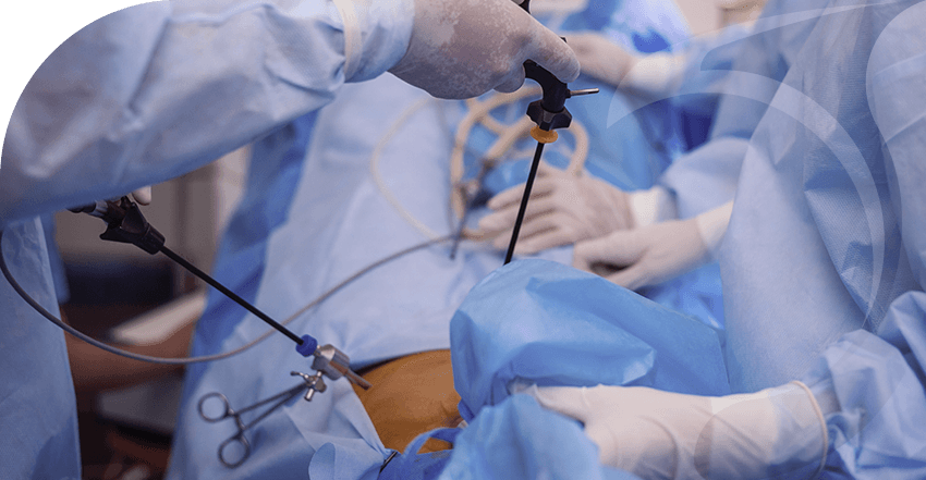 Videolaparoscopia: cirurgia minimamente invasiva - Clínica Wajman